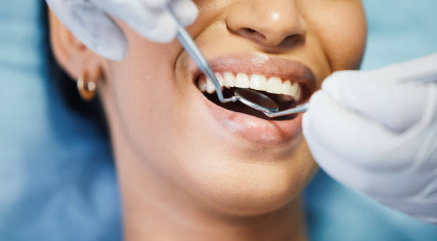 Best Emergency Denture Repair in Lake Riverside, CA